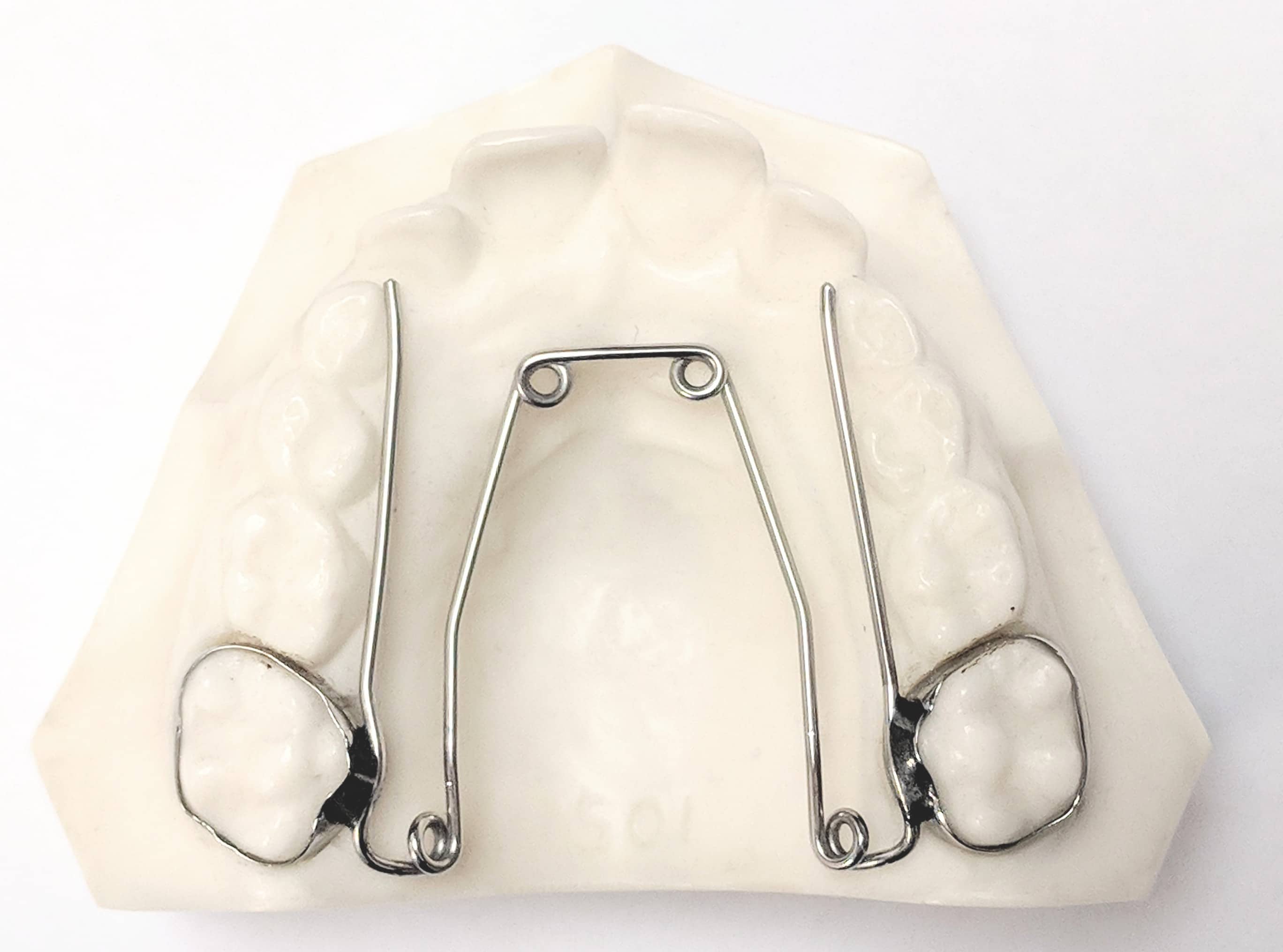 expander2-1 | True Orthodontics, PC