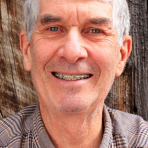 Senior Adult Man with Braces Smiling True Orthodontics