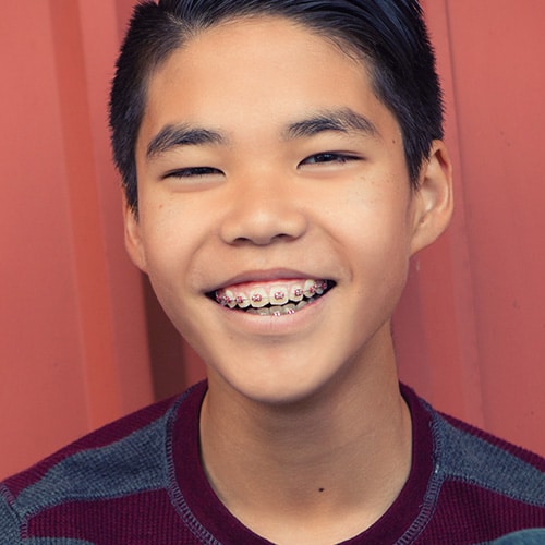 Teen with Braces Smiling True Orthodontics PC